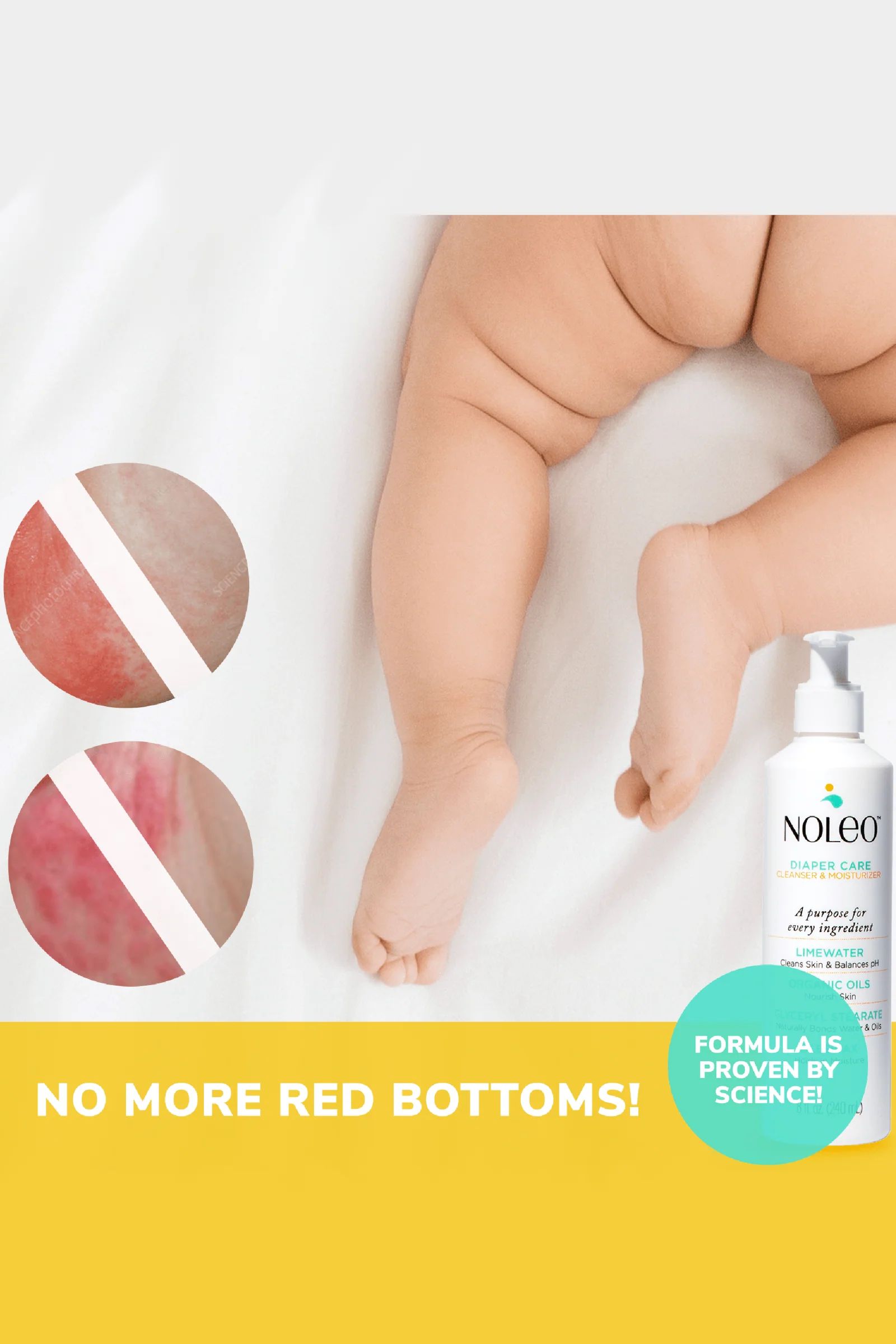 NOLEO 3-IN-1 Diaper Rash Cream, 16oz - Image 4